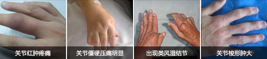F(yng)(qing)ֱt(y)ԺP(gun)(ji)[Û׃L(fng)Y(ji)(ji).jpg