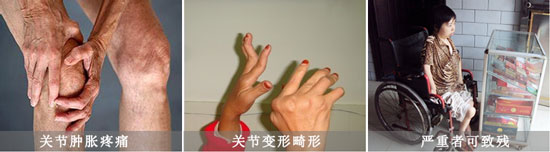 Fꖏ(qing)ֱt(y)ԺL(fng)(hu)(do)P(gun)(ji)[ʹΡ.jpg